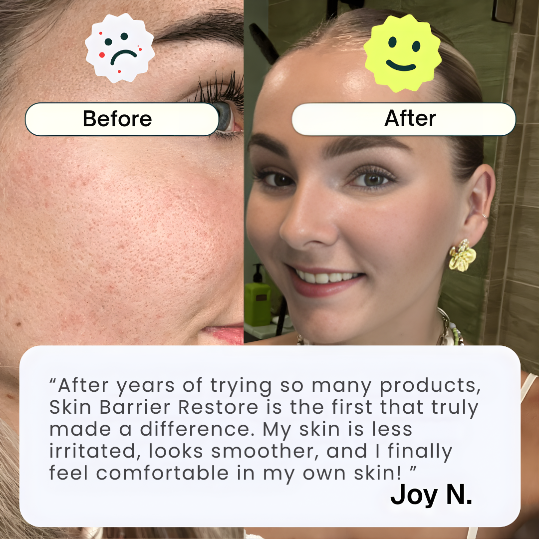 Skin Barrier Restore* Phytoceramides Complex