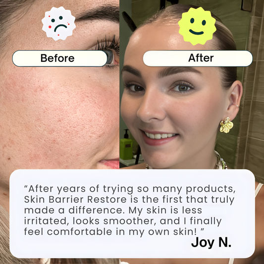 Skin Barrier Restore* Phytoceramides Complex